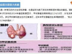 重疾险或不再全额赔付甲状腺癌21页.pptx