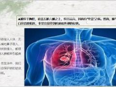每日健康肺有毛病的人睡觉时会有3种异常一个没占肺脏还算健康15页.ppt