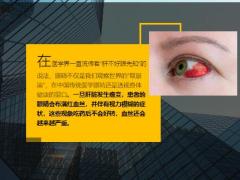 每日健康肝不好眼先知一旦眼睛有2种迹象很有可能是肝癌9页.ppt