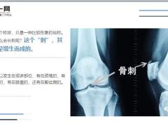 每日健康一个无比强大但快要失传的方子上治颈椎中治腰椎下治膝盖与脚跟12页.ppt