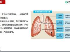 国寿福之常见病种介绍肺癌20页.pptx
