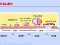 工银安盛御享颐生尊享版特定肿瘤切除术解析25页.pptx