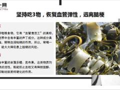 每日健康脑供血不足头晕头痛坚持吃3物恢复血管弹性11页.pptx