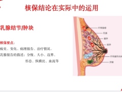 中华福2021版终身重大疾病保险谈论核保现阶段癌症花费增值服务37页.pptx