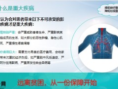 国联人寿明爱慧选重大疾病保险开发背景产品介绍投保规则案例演示35页.pptx