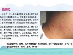 每日健康脖子上的小肉粒说明身体这里出了问题一定要注意6页.pptx