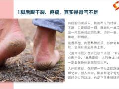 每日健康冬天脚后跟干裂小腿长鱼鳞真相不是皮肤缺水14页.pptx