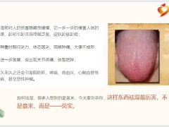 每日健康原来祛湿气最厉害的不是薏米而是芡实11页.pptx