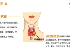 泰康内分泌系统疾病定义诊断指标解读分类核保评估尺度案例解析概况30页.pptx