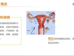 泰康女性常见疾病核保概述评估要点乳腺疾病分类与分级疾病评估32页.pptx