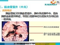 重大疾病知多少41页.ppt