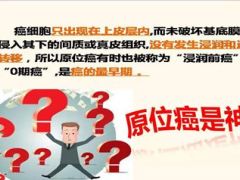 关于原位癌最简单明了的解释13页.ppt