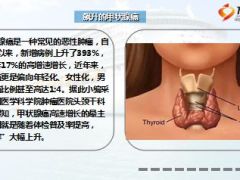 1500人体检15人罹患甲状腺癌已悄然高发12页.ppt