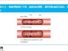 每日健康血管是如何一天天堵塞的看完吓一跳16页.ppt