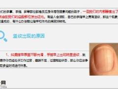 每日健康小心指甲上出现的竖纹这可能是体内器官病变的预兆11页.ppt