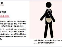 每日健康10个动作毁膝毁腰毁全身15页.ppt