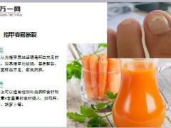 每日健康肝脏好不好从指甲知道10页.ppt