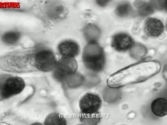 疾病视频流感下的北京中年.rar